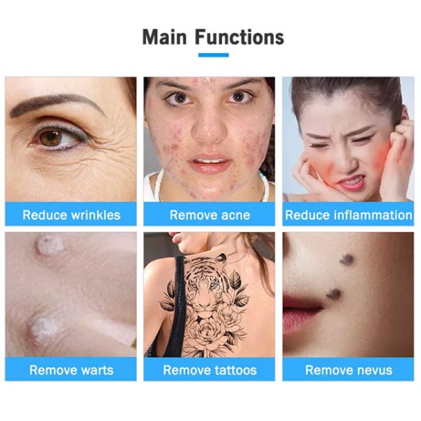 پلاسما فیوژن نیوفیس ایکس پل