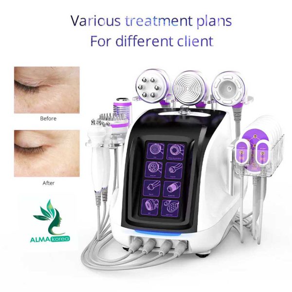 دستگاه آر اف وکیوم کویتیشن