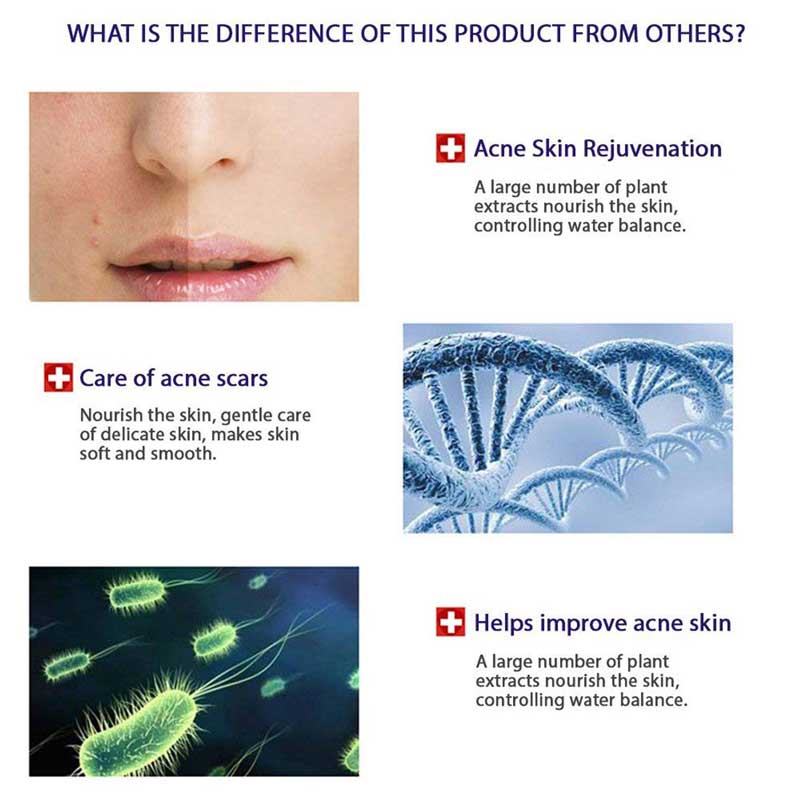 فوم ضد جوش و آکنه بیوآکوا