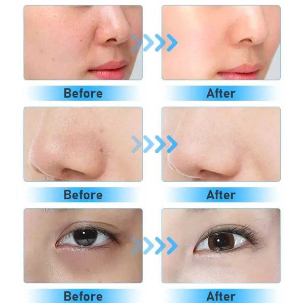 دستگاه هیدروفیشیال هفت کاره پلاسما هایکو