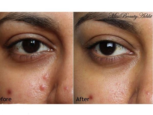 ژل کرم افکلار دو پلاس لاروش پوزای