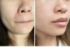 ژل کرم افکلار دو پلاس لاروش پوزای
