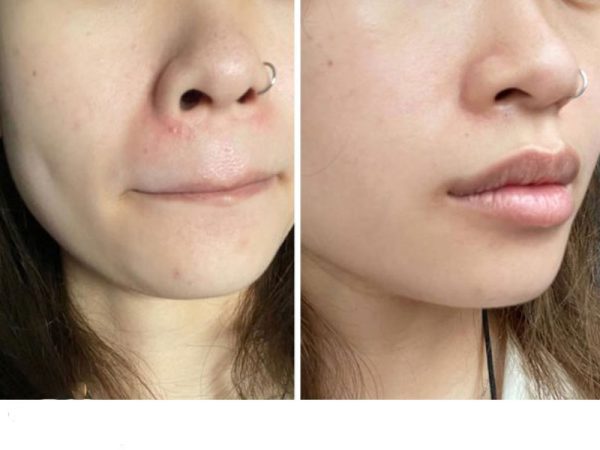 ژل کرم افکلار دو پلاس لاروش پوزای