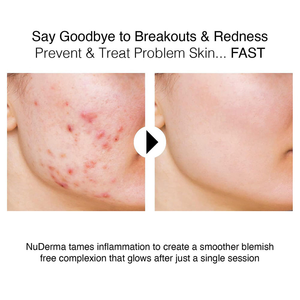 هایفرکانسی 4 پروپ نور قرمز هایکو