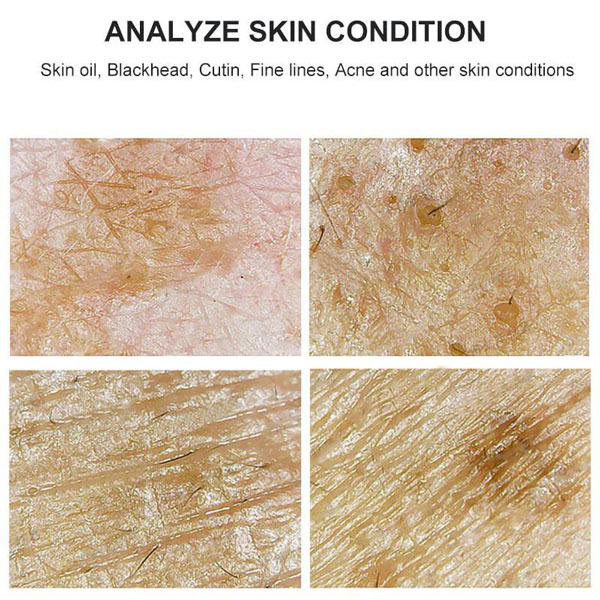 خرید مشخصات انالیزور پوست و موی بست کلین مدل 701