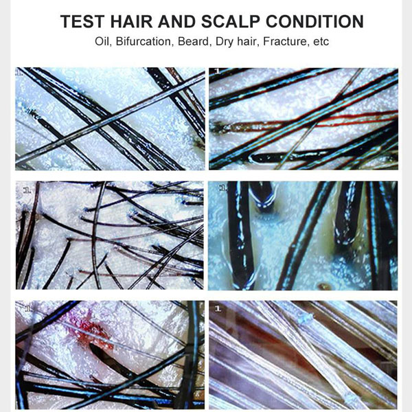 خرید و قیمت آنالیزور پوست و مو Best Klin مدل BD-701