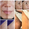 محلول احیا کننده سفید کننده