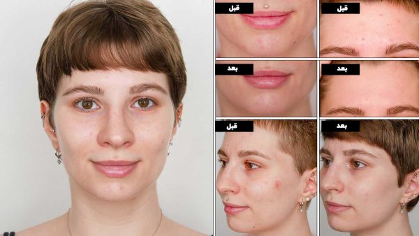 سرم آسکوربیک اسید اوردینری