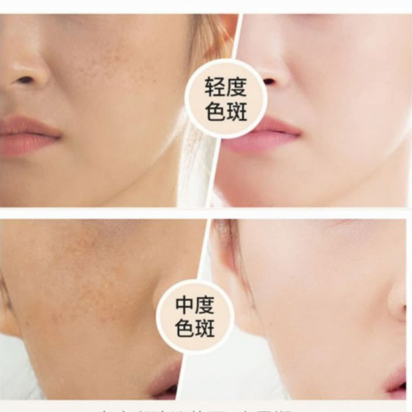 خرید و قیمت سرم جوانساز خون اژدها بوتکس Botex