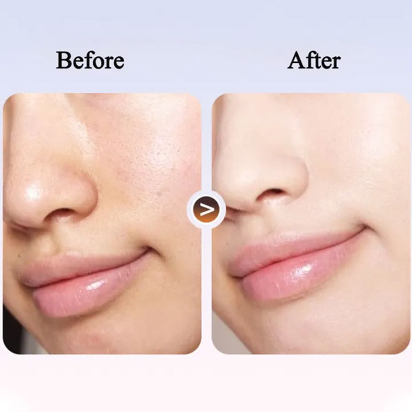 ترمیم کننده استی لادر 100 میل