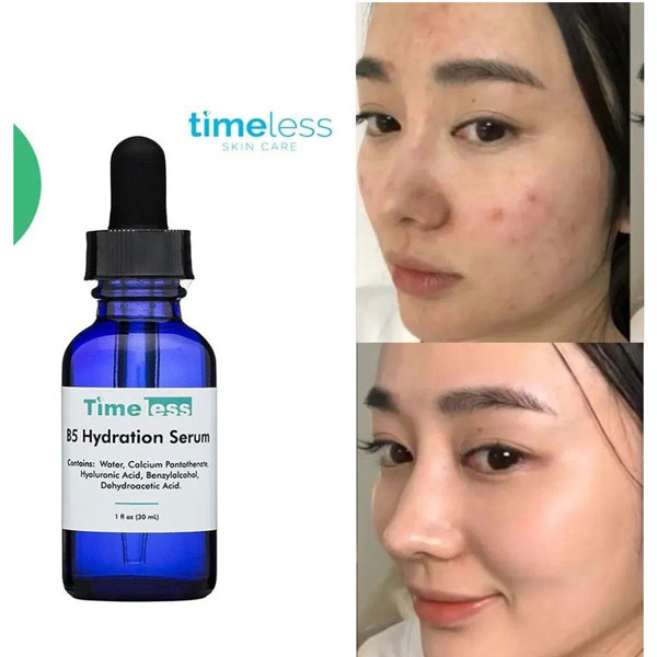 سرم صورت هیالورونیک اسید و ویتامین B5 تایملس