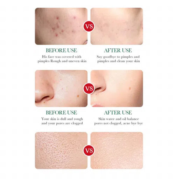 خرید سرم ضدجوش بیواکوا