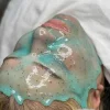 ماسک پودری هیدروژلی کیوی دکتر اسکین