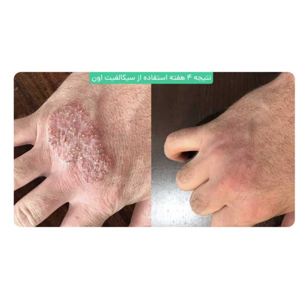 کرم ترمیم کننده سیکالفیت اون