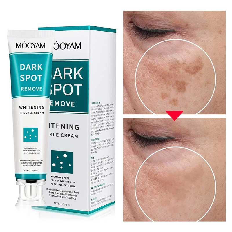 کرم رفع لکه های تیره مویام