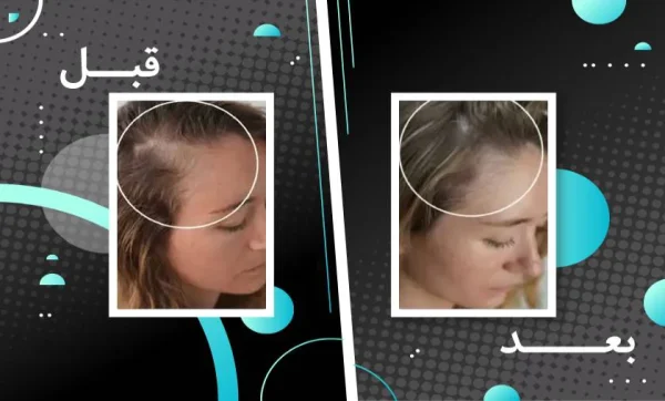 قرص تقویت کننده مو و ناخن فیتو فانر