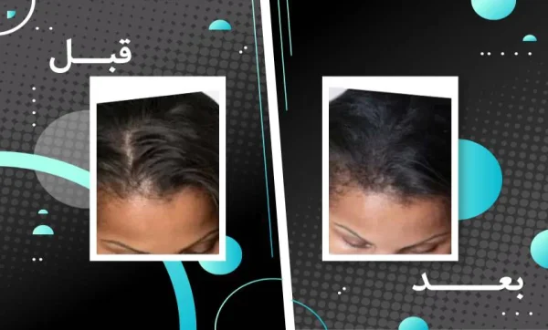 قرص تقویت کننده مو و ناخن فیتو فانر