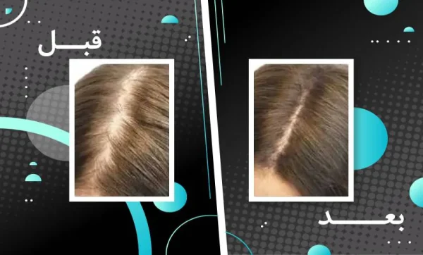 کپسول تقویت مو و ناخن فیتو فانر بسته 120 عددی - Image 6