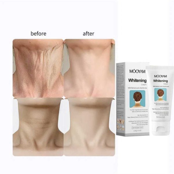 کرم سفید کننده پوست مویام