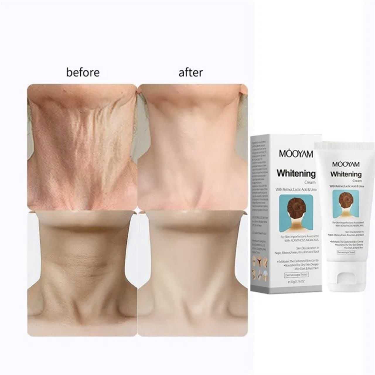 کرم سفید کننده پوست مویام