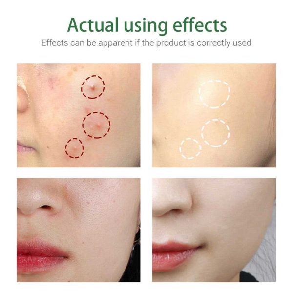 تاثیرات فوم شستشو درخت چای بریلی