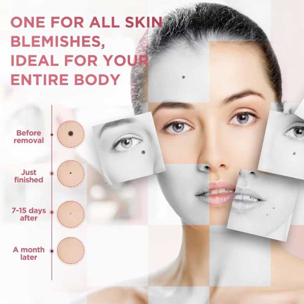 بیوتی پن 9 قدرته یونیزشن