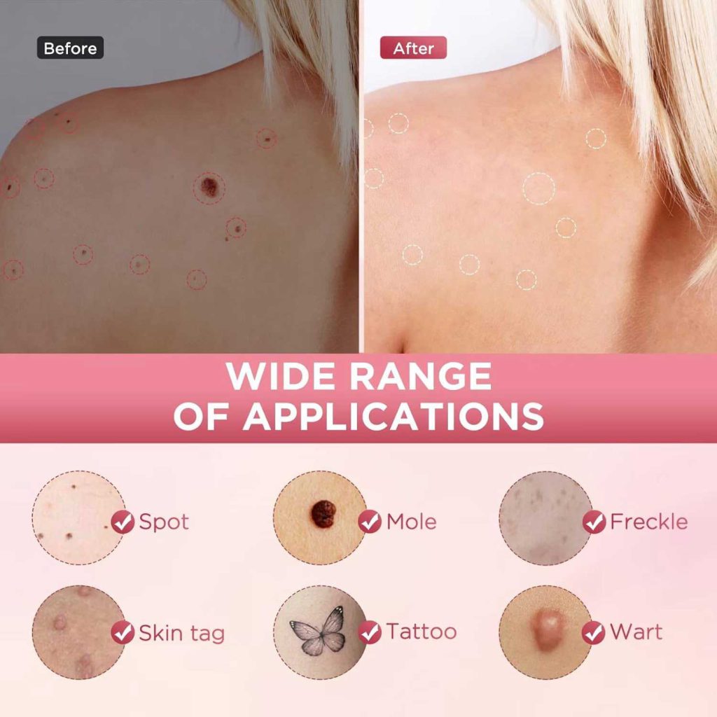 تاثیر بیوتی پن 9 قدرته یونیزشن