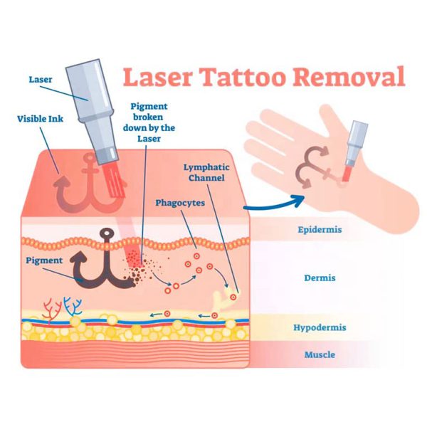 قیمت دستگاه لیزر کیوسوئیچ دراگون