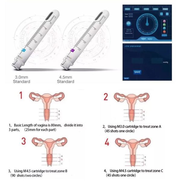 تاثیرات هایفو واژینال دراگون