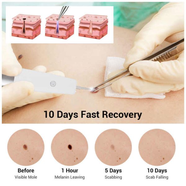 خرید بیوتی پن 15 قدرته مول