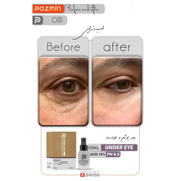 پیلینگ شیمیایی دور چشم ضد لک و چروک پازمین