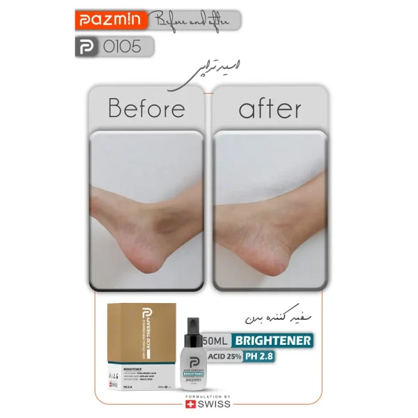 قیمت پیلینگ شیمیایی تخصصی ضدلک پازمین