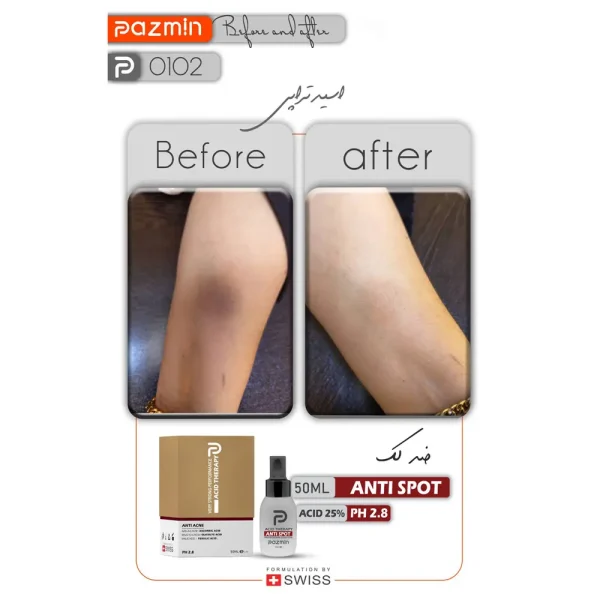 خرید پیلینگ شیمیایی روشن کننده بدن پازمین