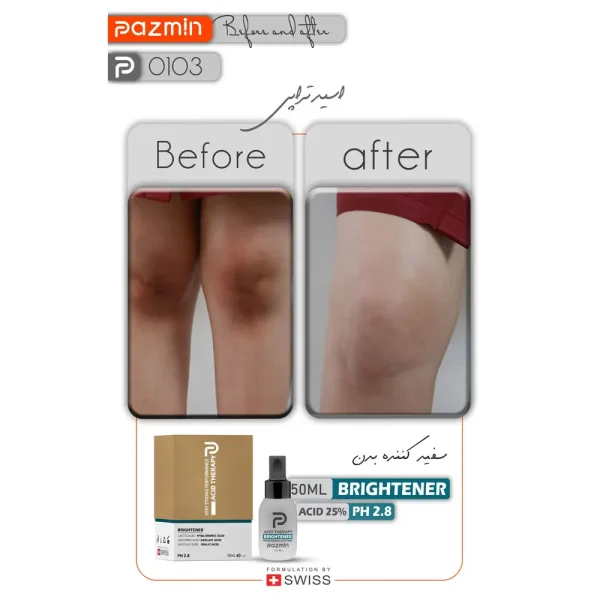 قیمت پیلینگ شیمیایی روشن کننده بدن پازمین