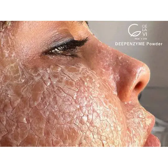 پک دیپ آنزیم سلاوی