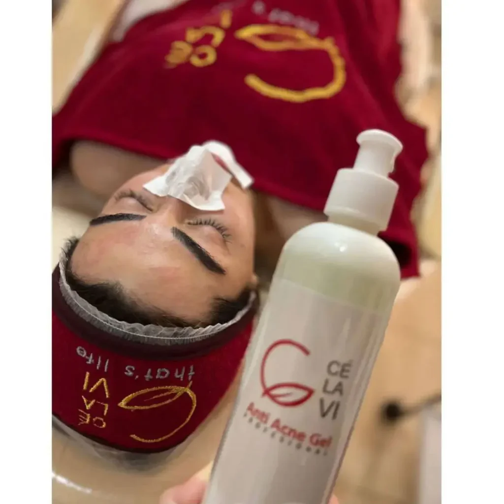 ژل ضد جوش سلاوی