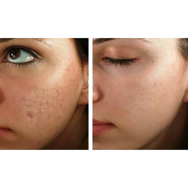 ژل ترمیم کننده سلاوی