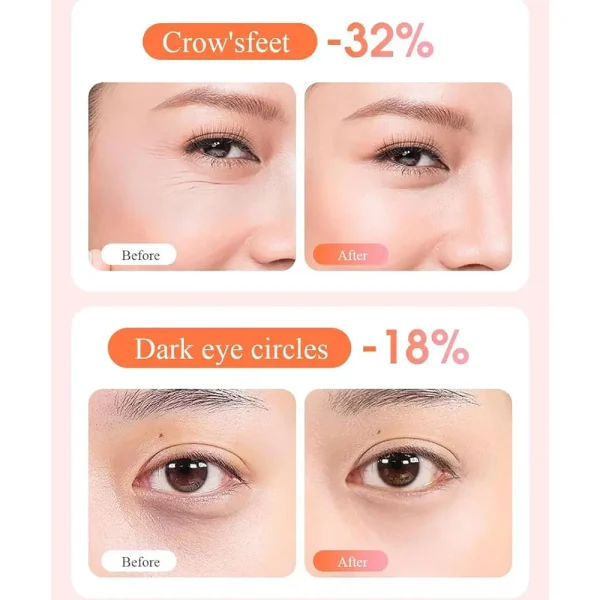 ماساژور لیفتینگ دور چشم سواپ اسکین