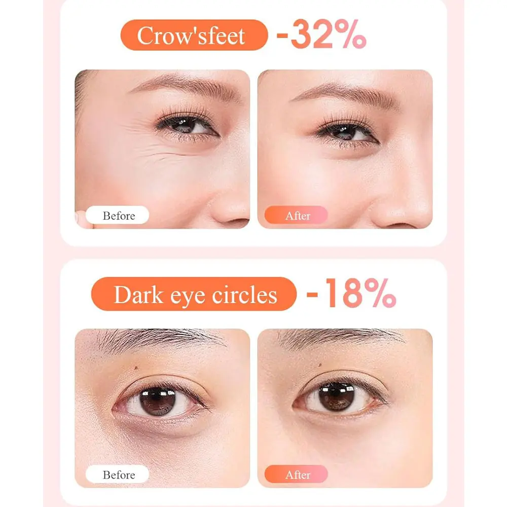 ماساژور لیفتینگ دور چشم سواپ اسکین