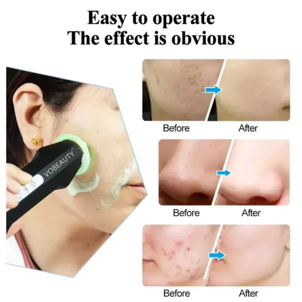 دستگاه پلاژن پرتابل اکسیژنو با 6 عدد کیت