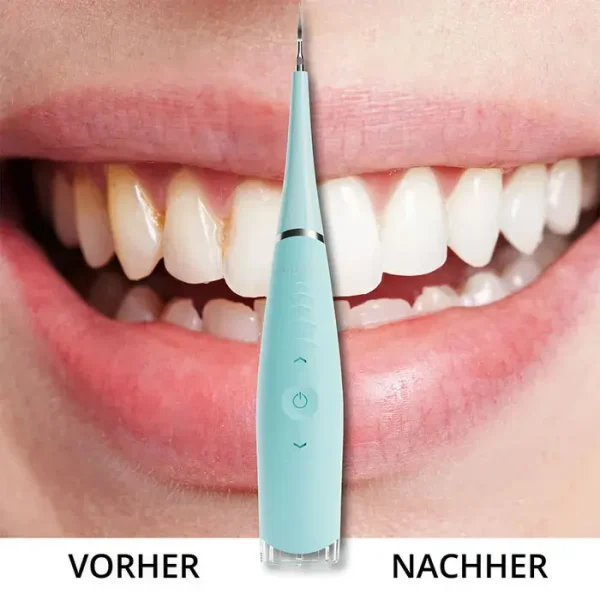 دستگاه جرم گیر دندان خانگی آیلوریا