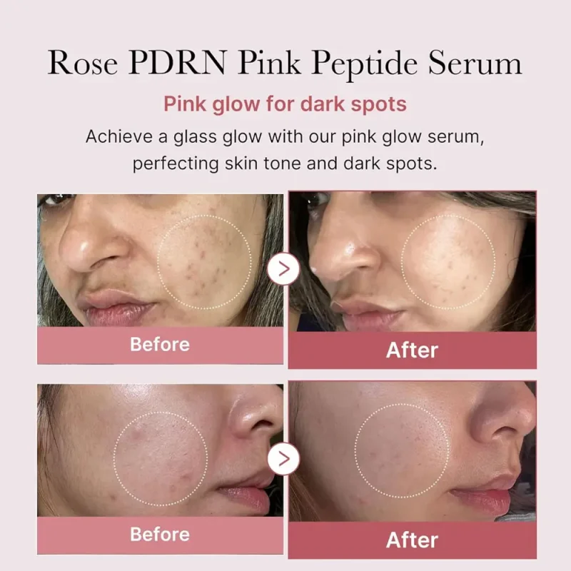 سرم جوانساز پپتاید و PDRN مدی کیوب