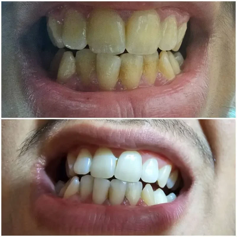 پودر جرمگیر و سفید کننده دندان اونیس