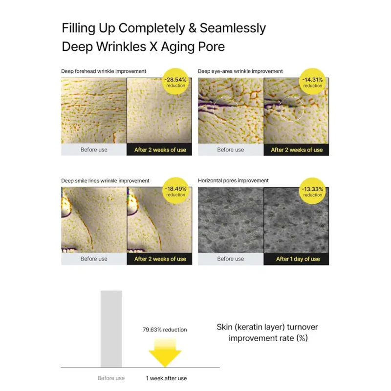 بوستر رتینال شات سلیمکس