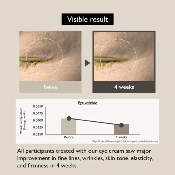 کرم دور چشم جوانساز هارو هارو