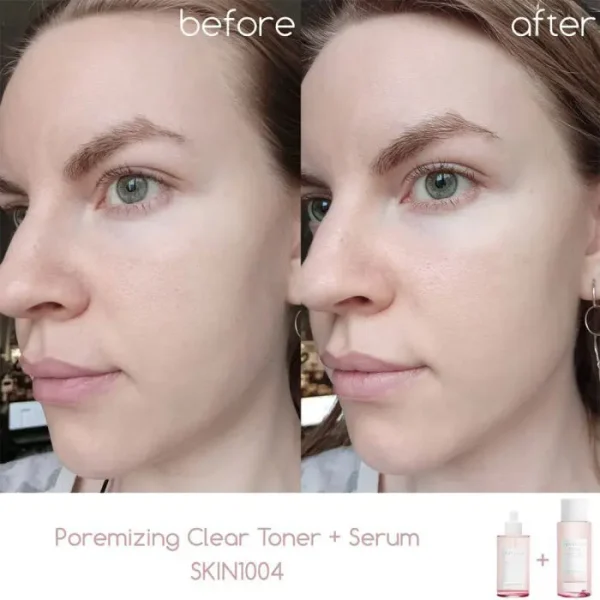 آمپول کنترل و کوچک کننده منافذ سنتلا ماداگاسکار اسکین 1004