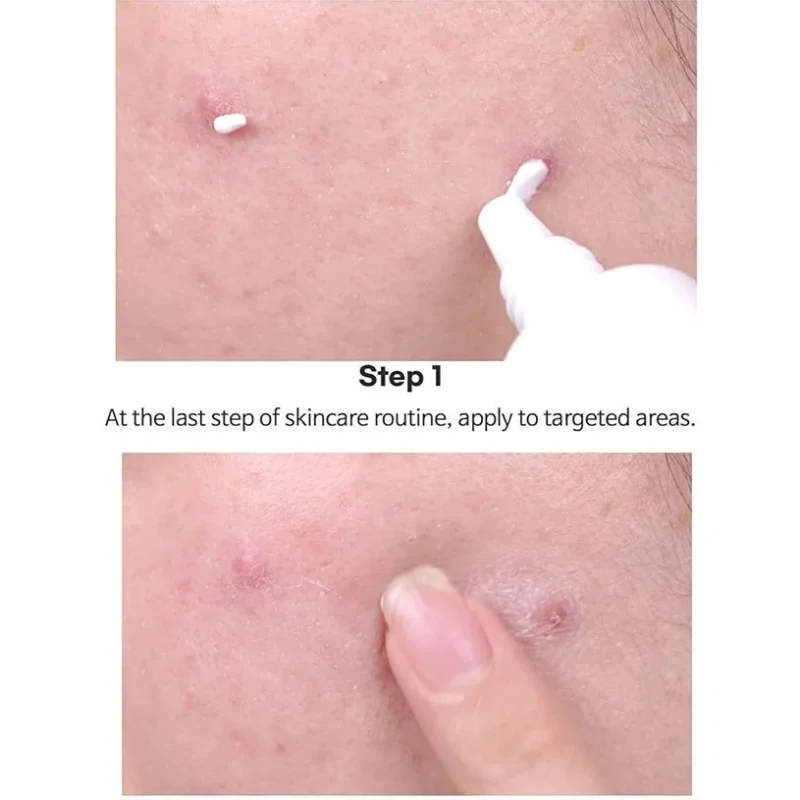 کرم نقطه ای ضد لک و جوش تیام