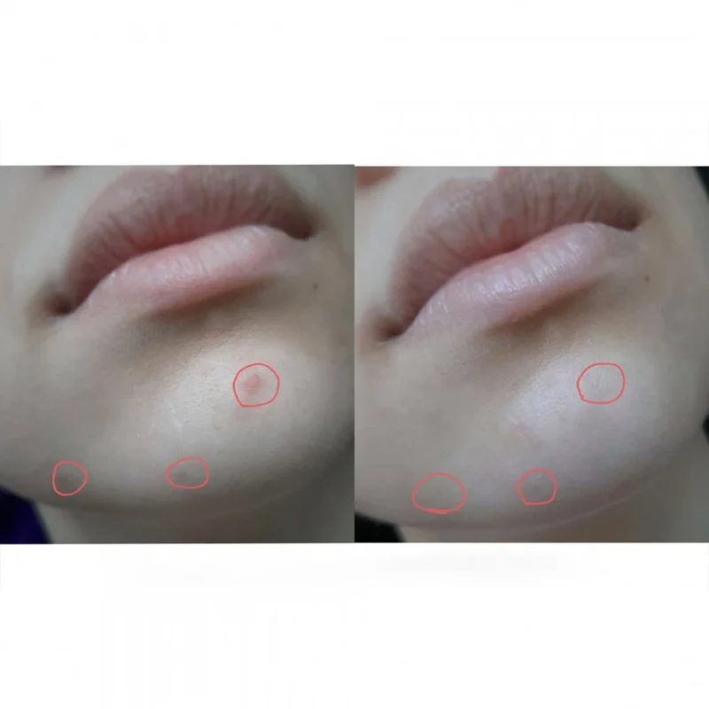 کرم نقطه ای ضد لک و جوش تیام